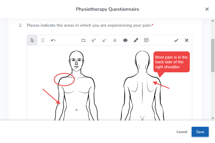 A screenshot showing a body chart on a form that has been marked up by a client.